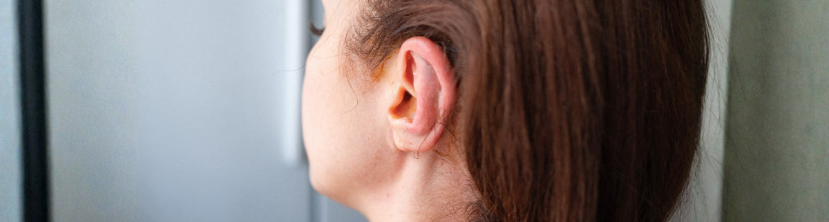 Suture Otoplasty (Incisionless Otoplasty) Sydney