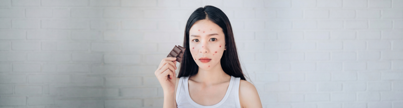 The Gut Skin Connection: Why Your Acne Woes Might Start Inside